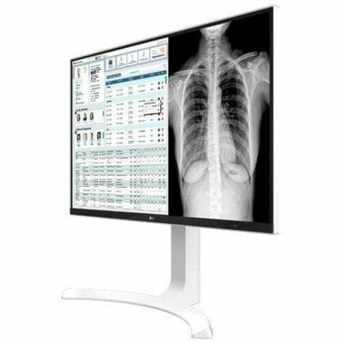 LG MED 27IN IPS 8MP 4K CLINICAL DISPLAY CALIBRATE WHITE