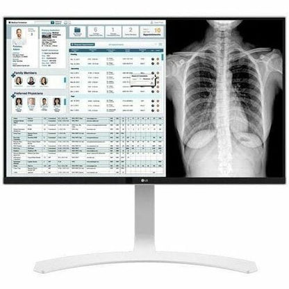 LG MED 27IN IPS 8MP 4K CLINICAL DISPLAY CALIBRATE WHITE