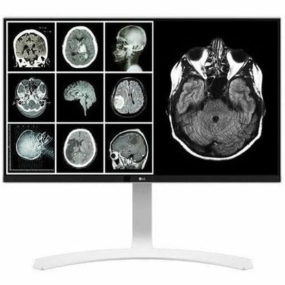 LG MED 27IN IPS 8MP 4K CLINICAL DISPLAY CALIBRATE WHITE