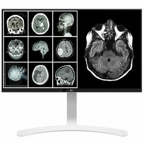 LG MED 27IN IPS 8MP 4K CLINICAL DISPLAY CALIBRATE WHITE