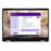 PB14250 ULTRA 5-236V SER 2 16GB 512GB SSD 14IN W11